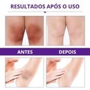 Creme Clareador Axila e Virilha - Sexy Pink - Nacional Shoppe