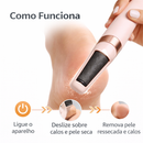 Removedor de Calos Elétrico Feet Cleaner
