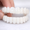 Facetas Dentárias Removíveis